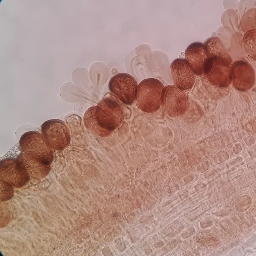 Roya al microscopio, imagen de SmartSoil